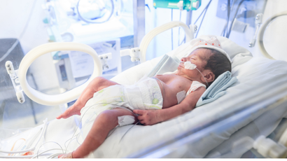 Ventilação Mecânica em Neopediatria